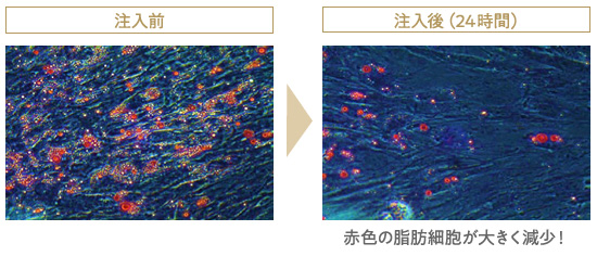 注入前/注入後の比較イメージ